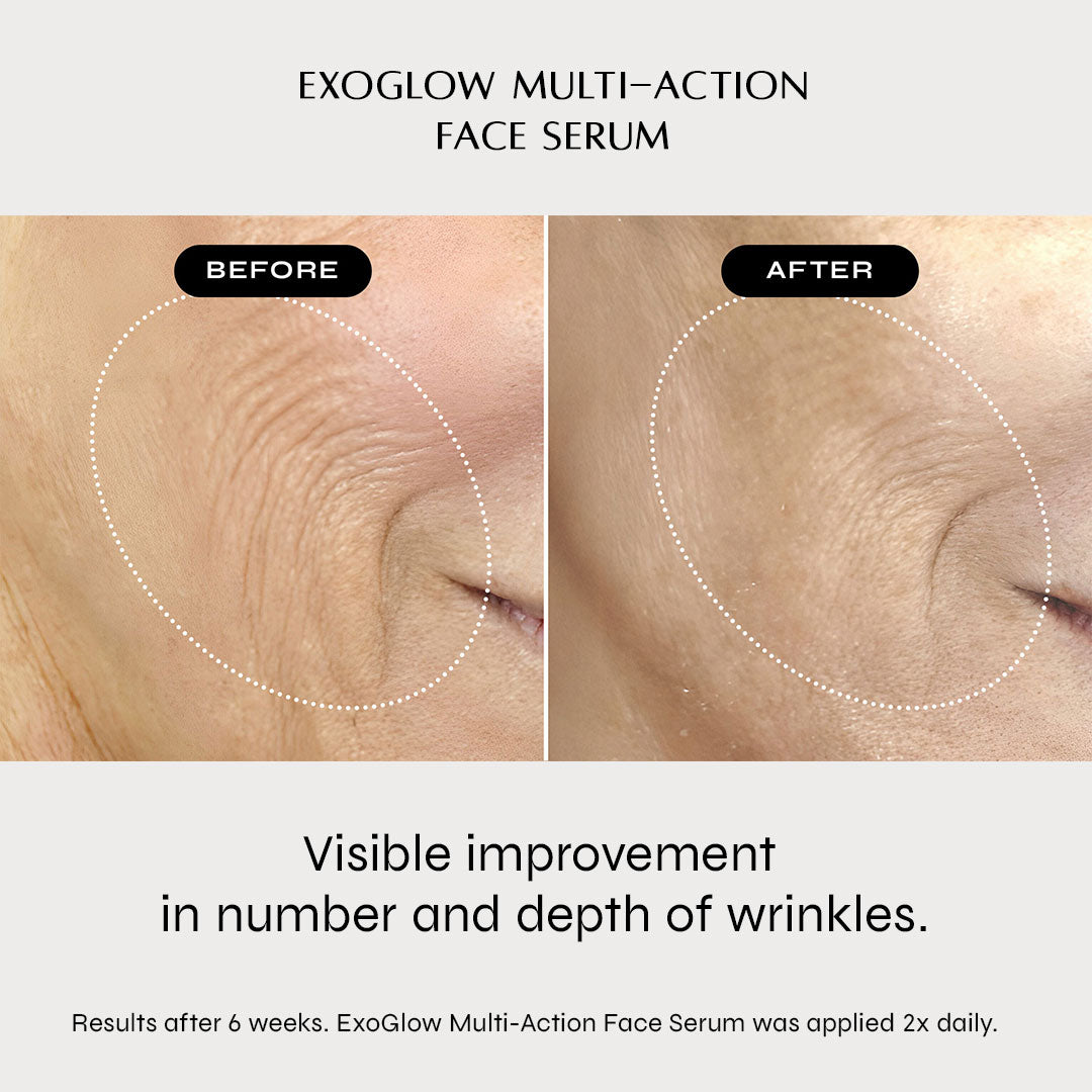 ExoGlow Multi-Action Face Serum