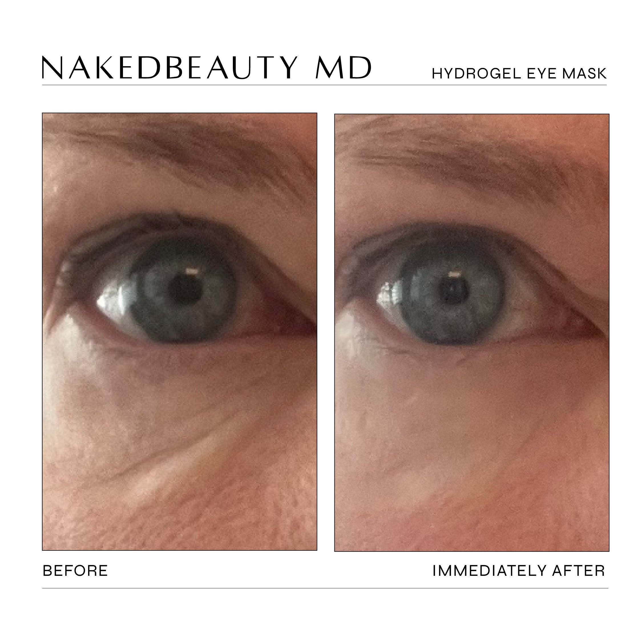 Damask Rose Revitalizing Gold-Infused Hydrogel Eye Masks