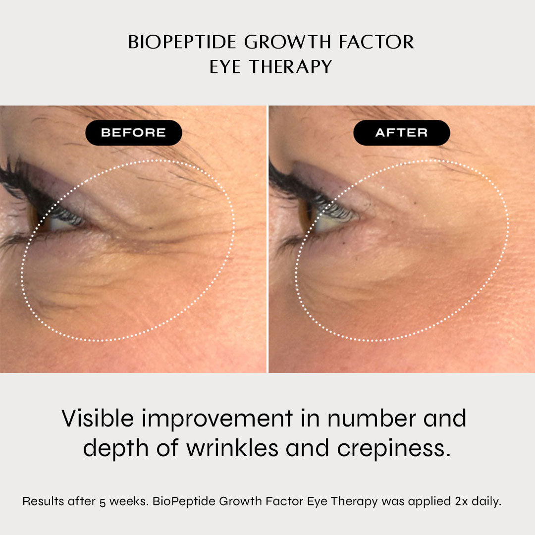 BioPeptide Growth Factor Eye Therapy