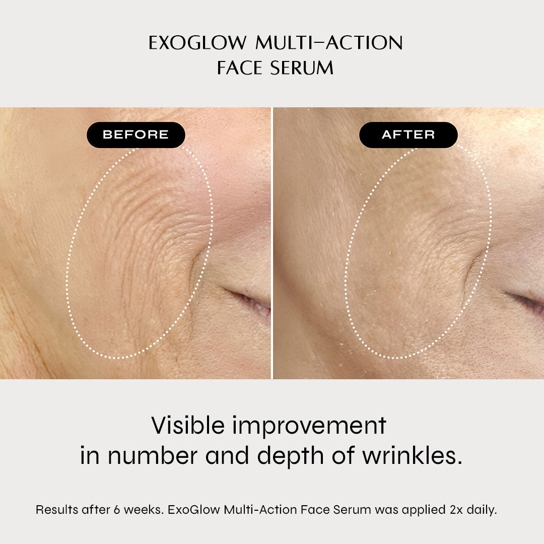 ExoGlow Multi-Action Face Serum