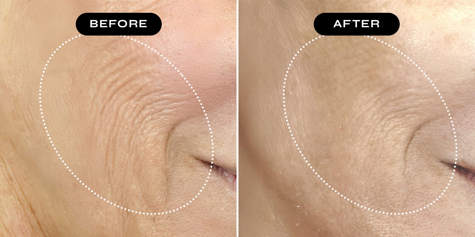 Best Medical-Grade Peptide & Growth Factor Skincare | NakedBeauty MD